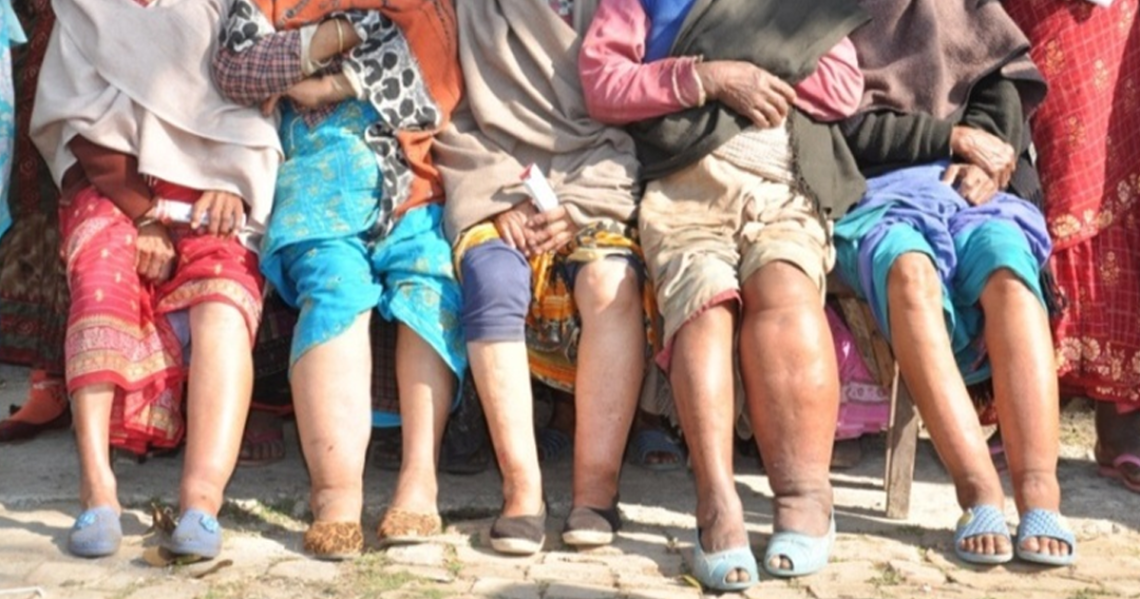 झापामा आजदेखि हात्तीपाइले रोगविरुद्धको औषधि खुवाइँदै