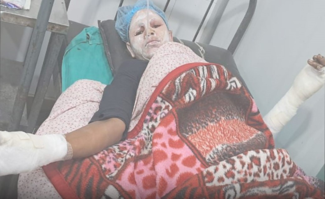 घरायसी विवादले लियो जघन्य रूप, दुहबीमा महिलामाथि पेट्रोल छर्केर आगो