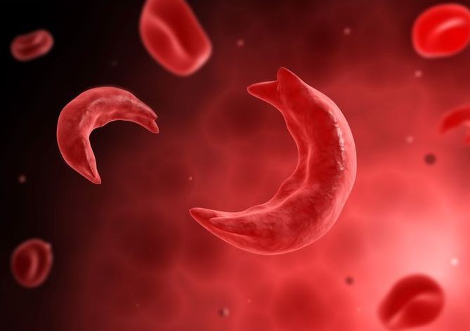 सिकलसेल एनिमियाबाट पश्चिम तराईका १५ जिल्ला प्रभावित