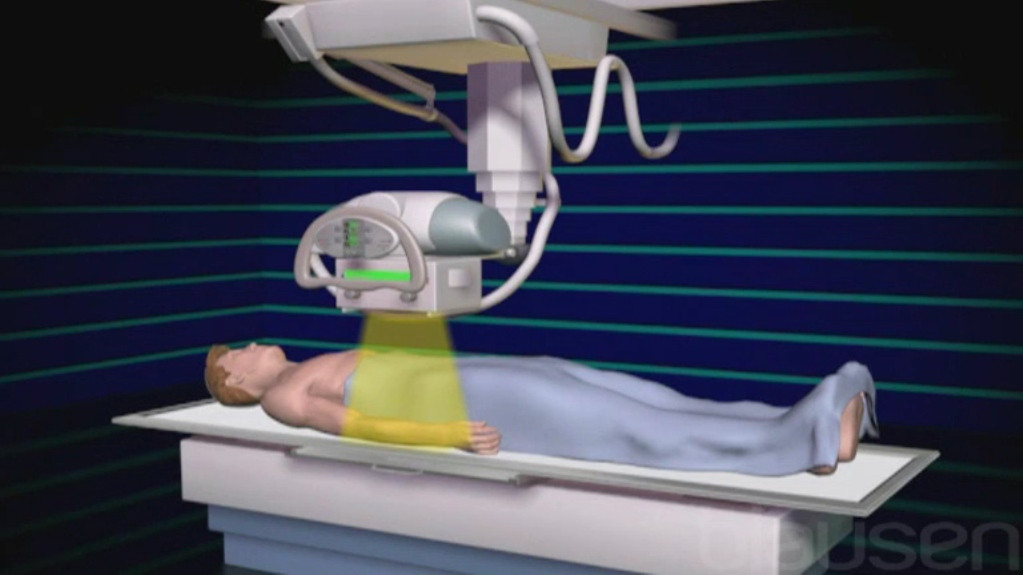 जिल्ला अस्पताल खोटाङको एक्सरे सेवा बन्द हुँदा सेवाग्राही मारमा