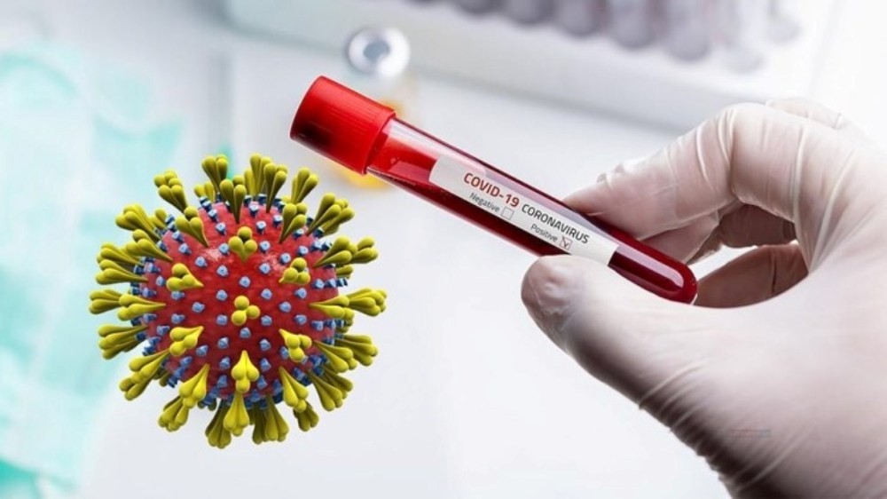 कैलाली र कञ्चनपुरमा आजबाट र्यापिड टेस्ट