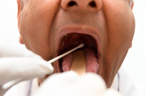 आछाममा दुई सय जनाको थ्रोट स्वाब संकलन