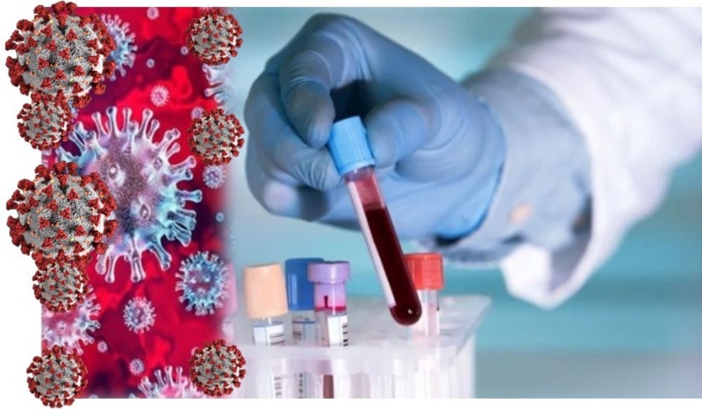 देशभर थपिए १८३ जना कोरोना संक्रमित, थप २ को मृत्यु