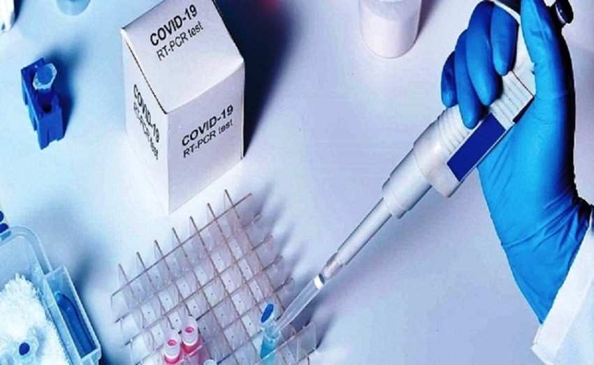 यूएईमा कार्यरत नेपालीले पठाएको ५९ हजार थान पीसीआर कीट आइपुग्यो