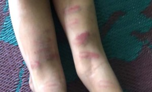 गृहकार्य नगरेको भन्दै झापामा शिक्षिकाद्धारा विद्यार्थीमाथि निर्घात कुटपिट