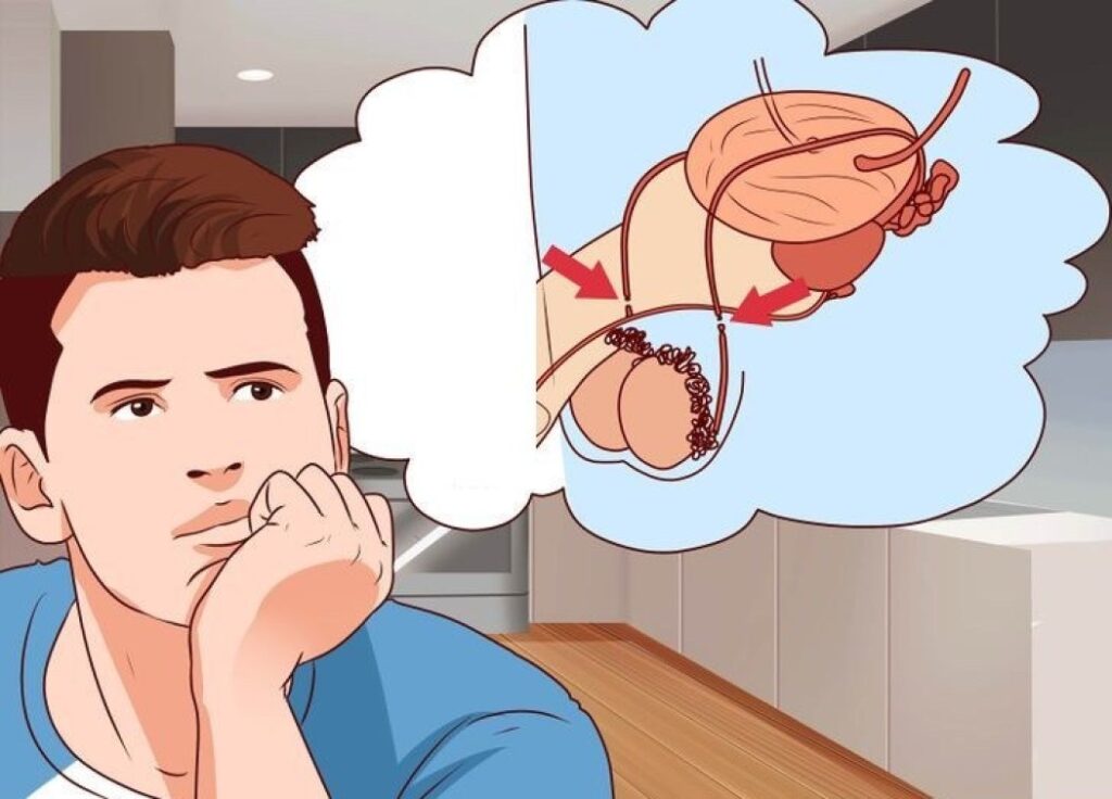 बन्ध्याकरणमा पुरुषको ‘क्याम्प’ खाली