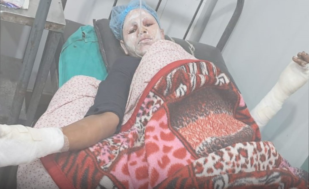 घरायसी विवादले लियो जघन्य रूप, दुहबीमा महिलामाथि पेट्रोल छर्केर आगो