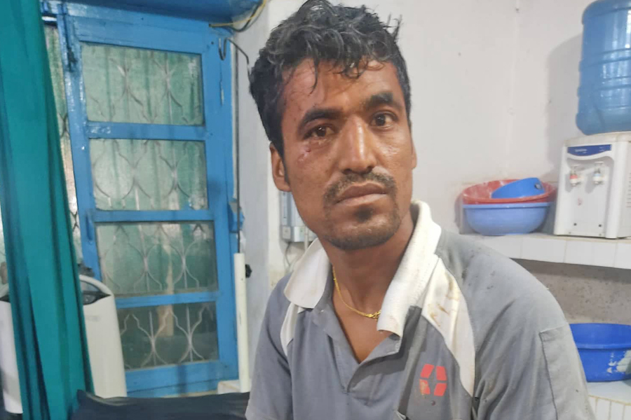 गुल्मीमा चितुवा र युवकको घम्साघम्सीः युवक घाइते, चितुवा मर्यो 